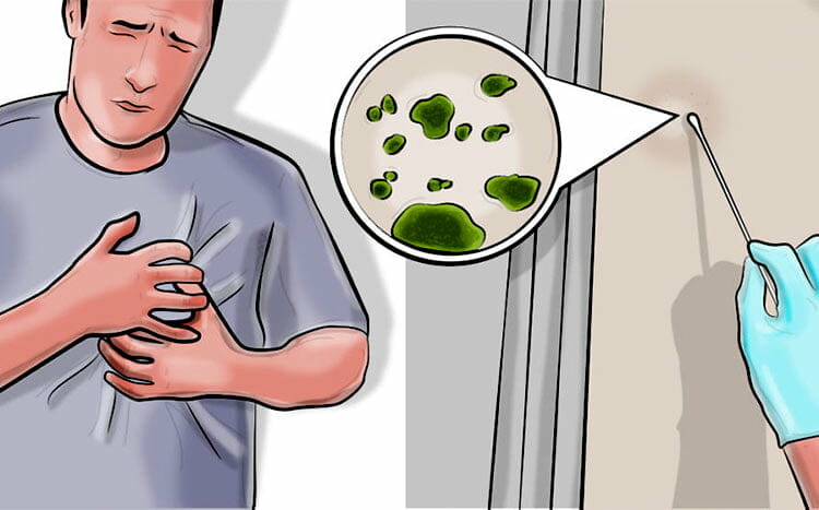 What Are the Early Warning Signs of Mold Toxicity picture
